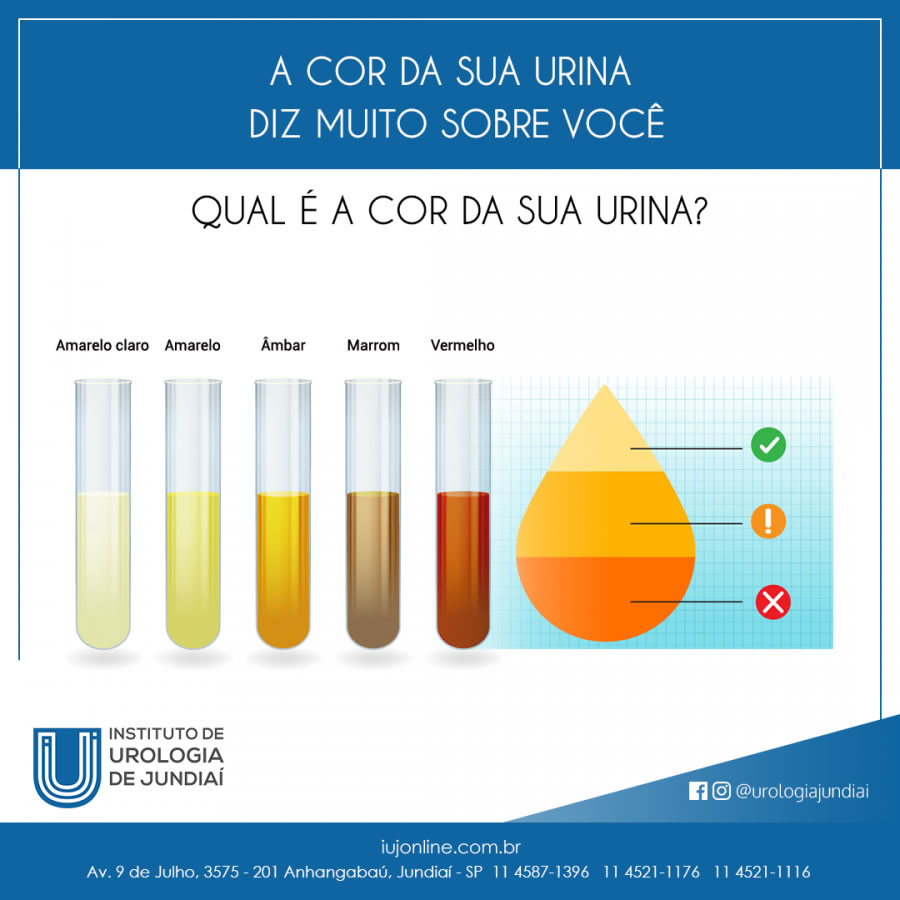 A cor da sua urina diz muito sobre você