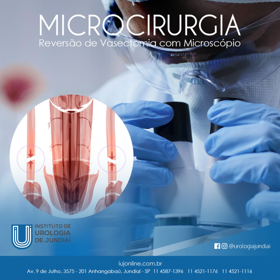 Microcirurgia (Reversão de Vasectomia com Microscópio)