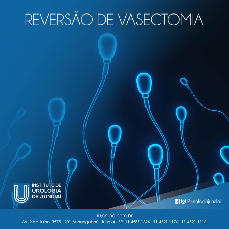 Reversão de Vasectomia