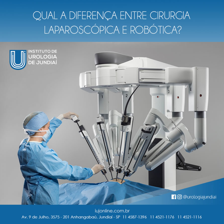 Qual a diferença de cirurgia laparoscópica e robótica?