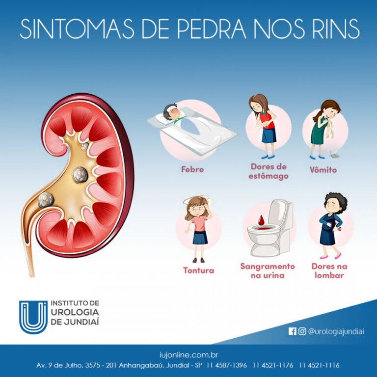 Sintomas de Pedra nos Rins - Instituto de Urologia de Jundiaí